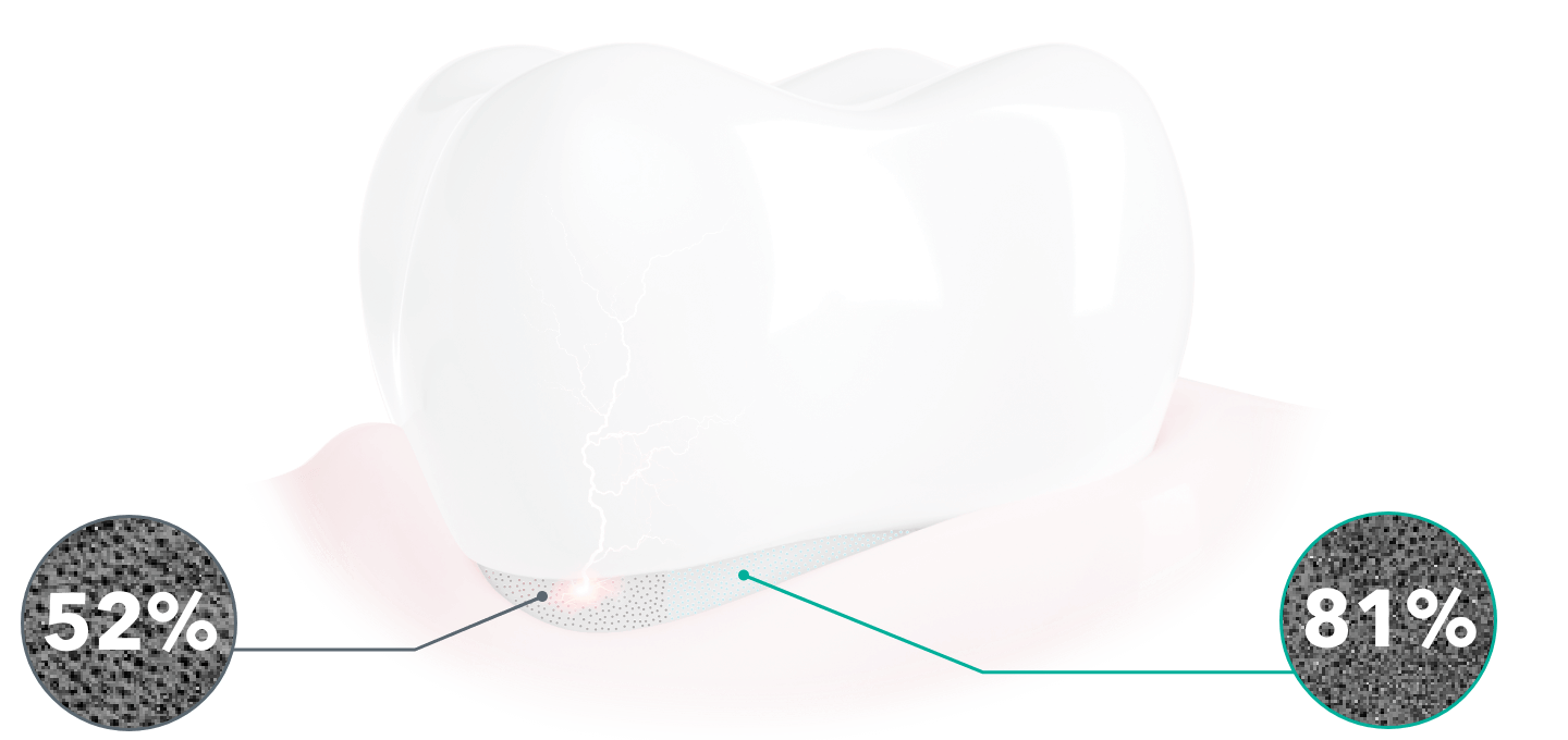 tehnologie elmex pro argin