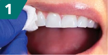 czyszczenie zębów ściereczką