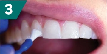 nakładanie produktu na ząb