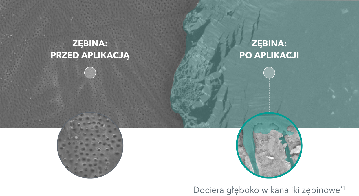 ZĘBINA: PRZED APLIKACJĄ